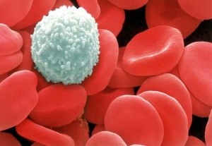 Leukémia (rakovina krvi) - biologická liečba a cielená terapia