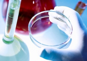 Vyšetrenia pre správnu diagnostiku mnohopočetného myelómu